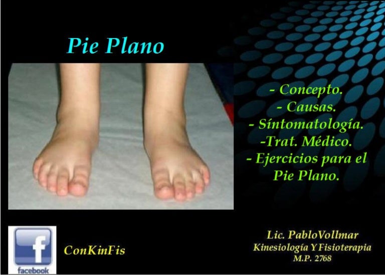 ejercicios de risser pie plano